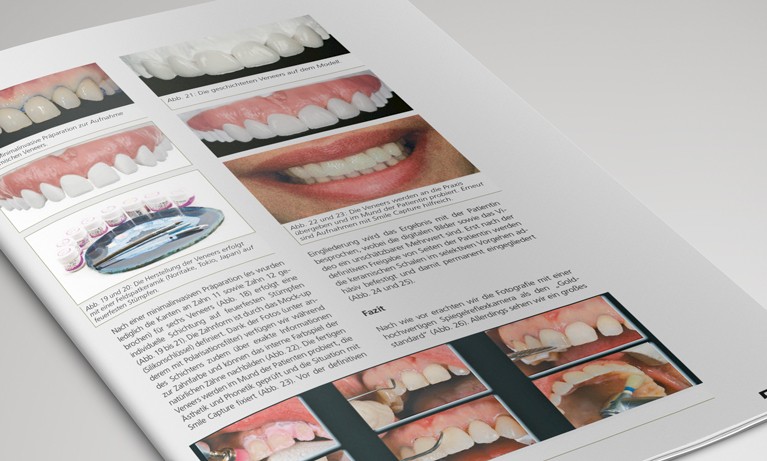 Digitale Dentalfotografie -  Der einfache Weg
